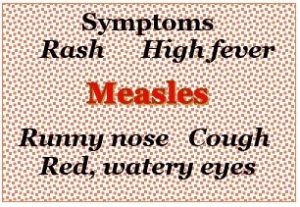 measles update in your office