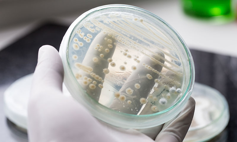 Candida auris (C. auris)